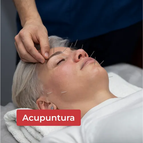 acupuntura-capa.webp